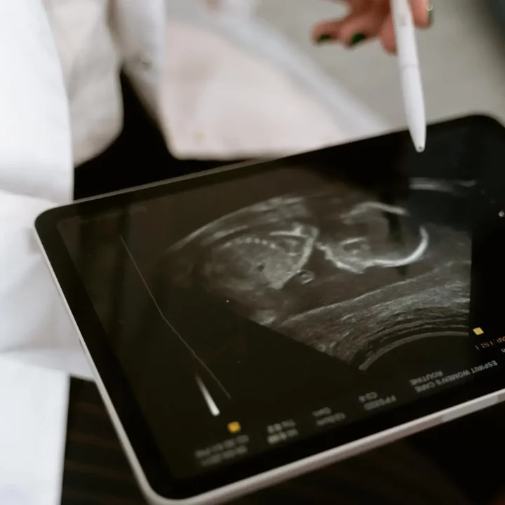 Zbliżenie na lekarkę trzymającą w dłoniach tablet z USG.